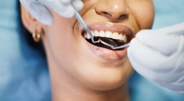 Best Emergency Dental Care for Sports Injuries in Evansdale, IA